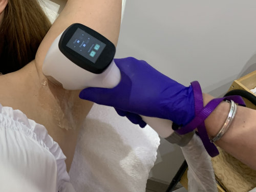 Szőrtelenítés hormonális problémák esetén - van megoldás